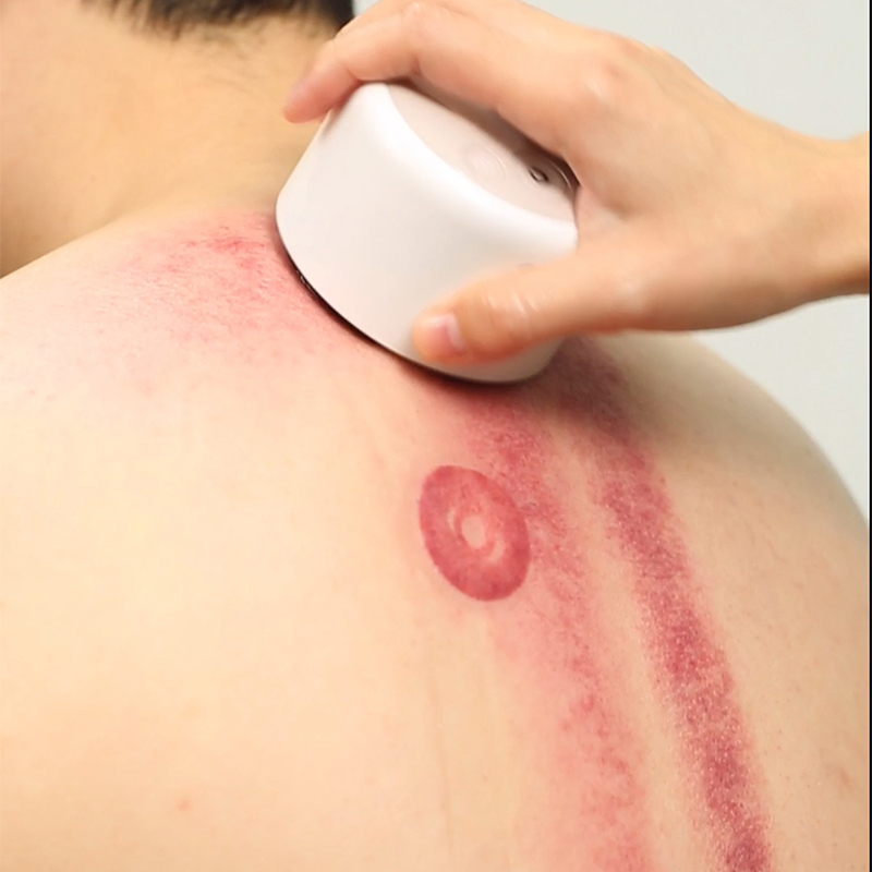 Black Bian Stone Smart Electric Cupping Massage Product Gua Sha Massage 2022 New Product