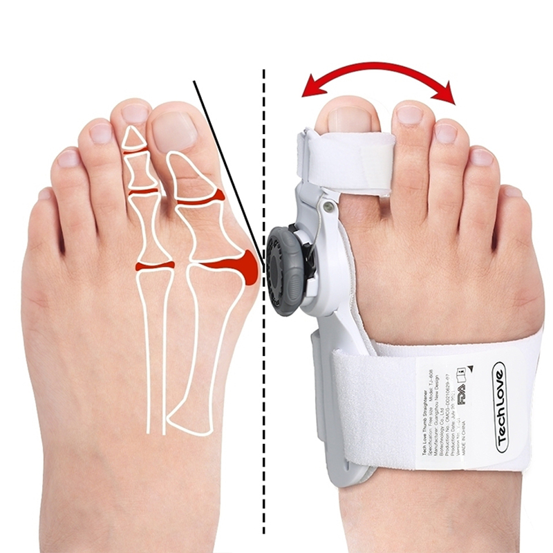 Multi-directional fixed foot Bunion Splint Separator Orthopedic Toe Corrector Adjustable Hallux Valgus For Foot Care Products