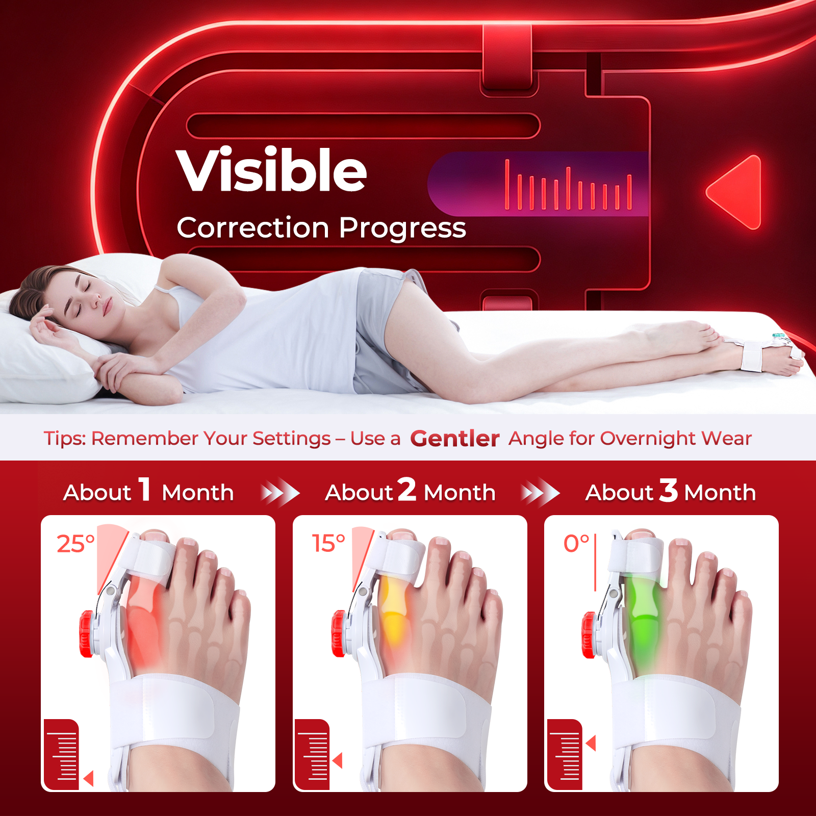 Bunion Correctors: How to Choose One and Use It Without Wasting Money