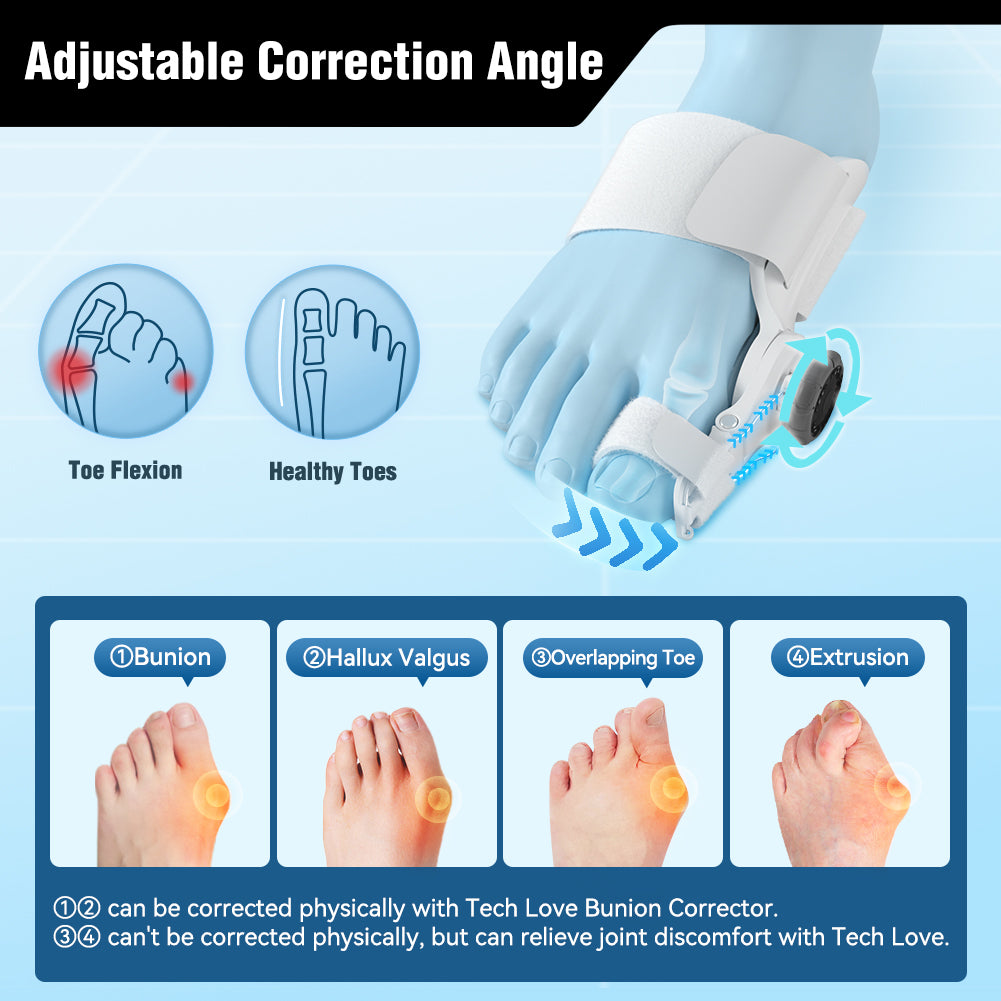 Tech Love X2 Adjustable Hallux Valgus Correction Device